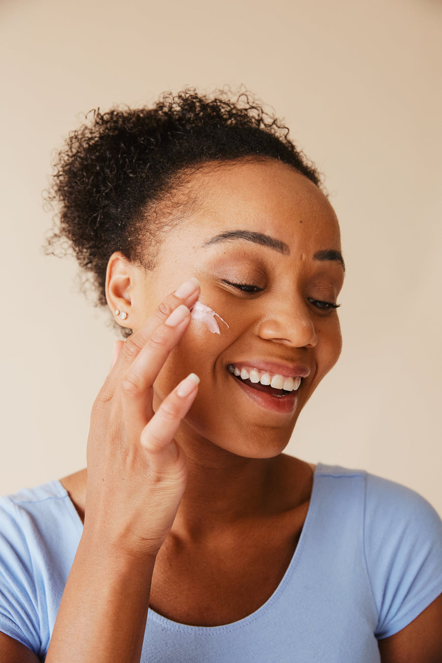Melasma or ordinary pigmentation: telling them apart