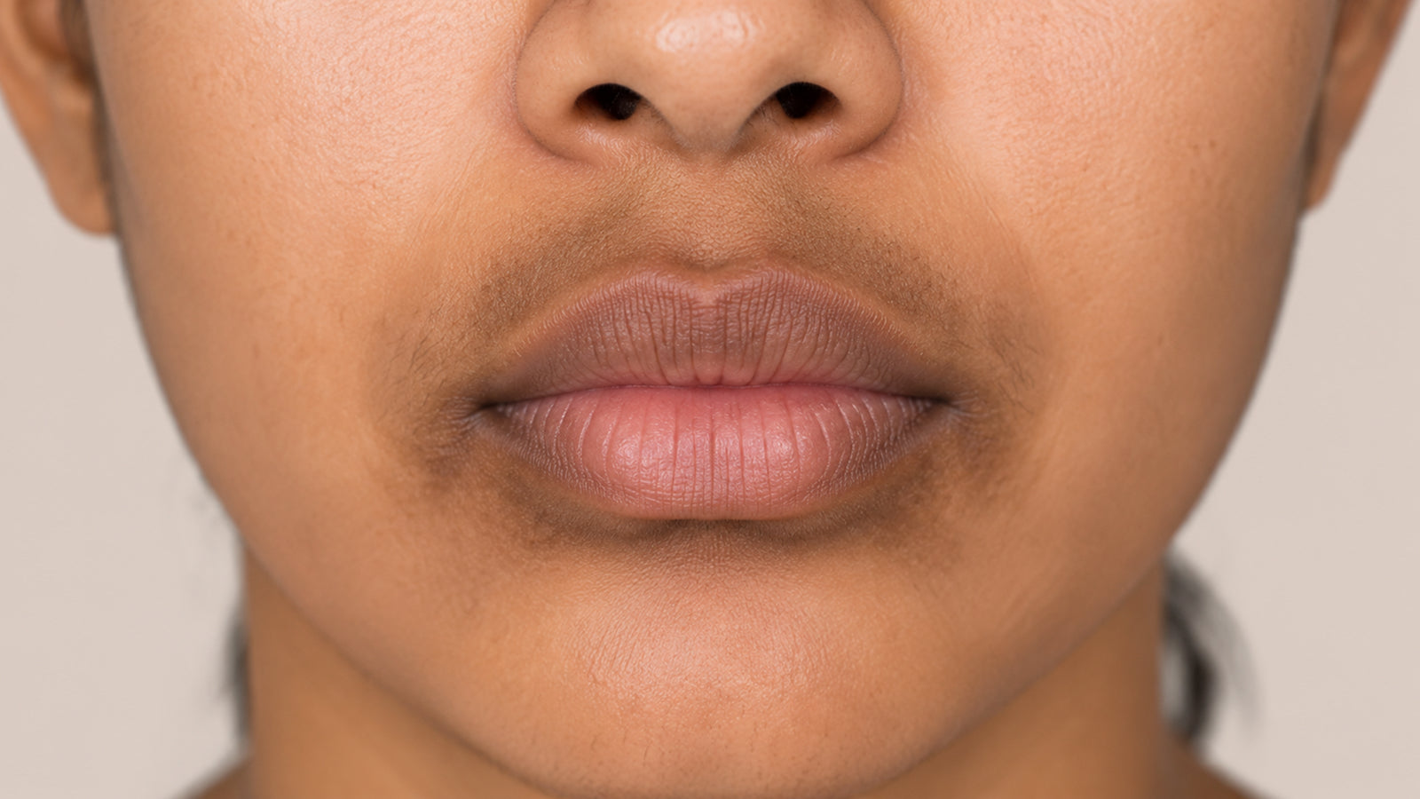 Dark patches on and around the lips